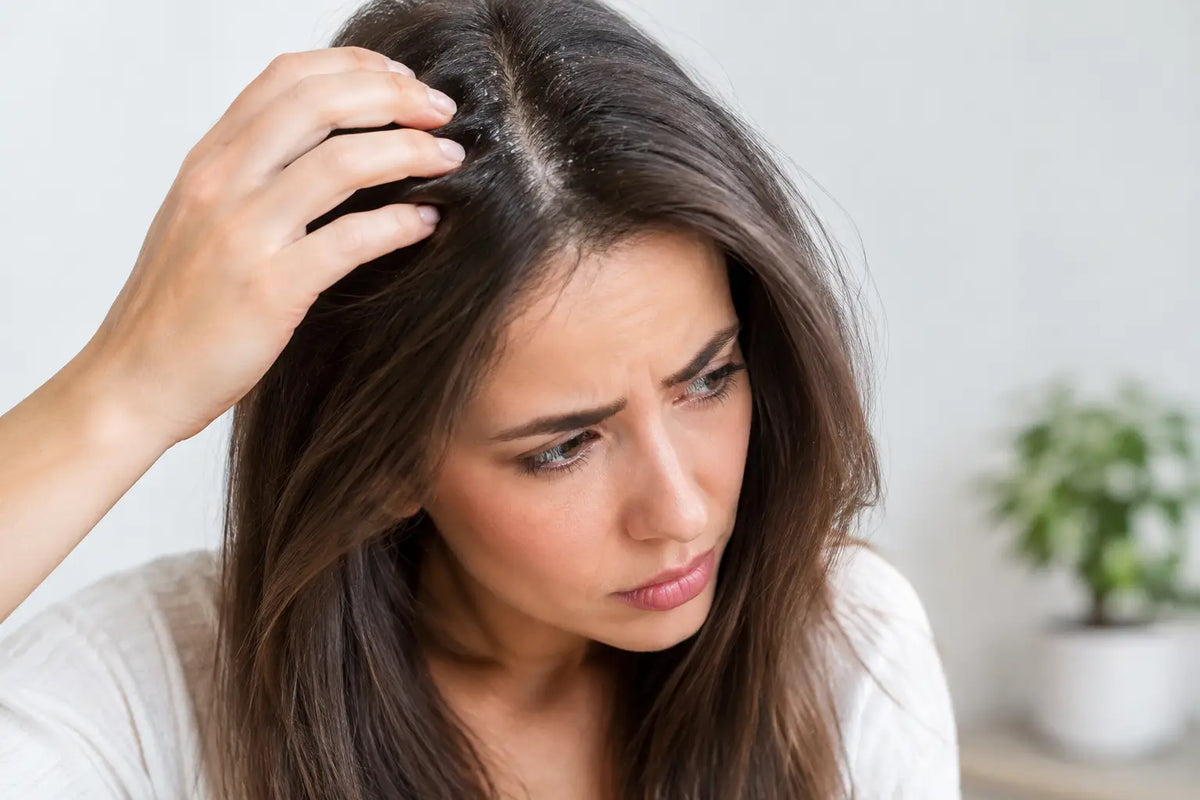 What Causes Flaky Scalp Skin? Common Triggers