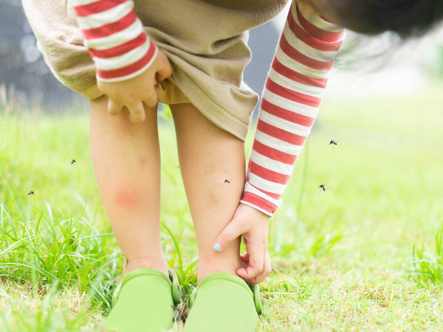 Treating Insect Bites Naturally